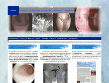 Tablet Screenshot of histeroscopia.es